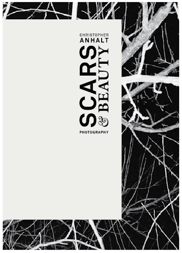 Scars and Beauty Christopher Anhalt